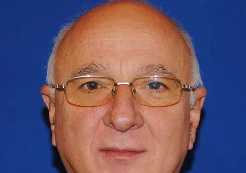 COMPENSAŢII NESIMŢITE pentru membrii Consiliului Autorităţii de Supraveghere Financiară