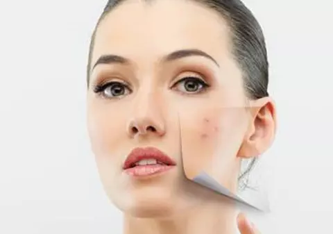 Peelingul cu enzime, SOLUŢIA RAPIDĂ pentru UN TEN MAI TÂNĂR