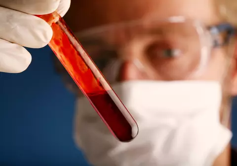 Sute de analize pentru depistarea HIV/SIDA, falsificate la Spitalul Judeţean din Târgu Jiu