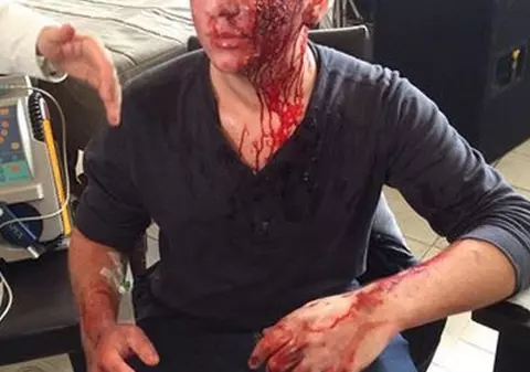 Fiul Clejanilor, plin de sânge, cu răni deschise şi vânăt! Iată cu CE SUPER MACHIAJ A BĂGAT-O ÎN SPERIEŢI PE VIORICA!