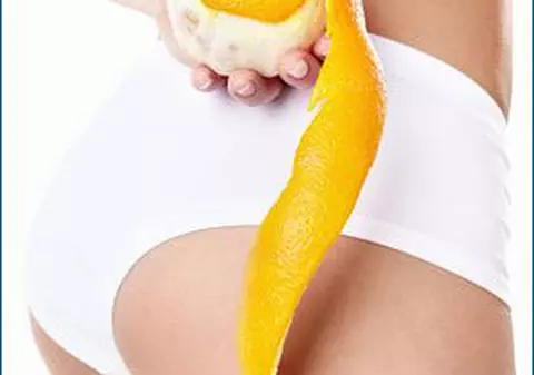 (P) Află metodă naturală de a scăpa de celulită, pe care nu o vei afla din saloanele de cosmetică!