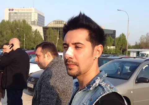 Adi Cristescu a apărut la ZU Music Awards CU NASUL PANSAT