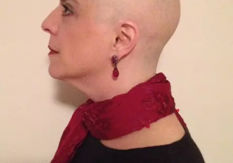 A aflat că are cancer şi şi-a făcut o poză pe zi. Vezi cum s-a transformat o femeie din America | VIDEO