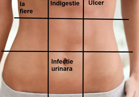 Ce boli poţi să ai în funcţie de locul unde te doare burta