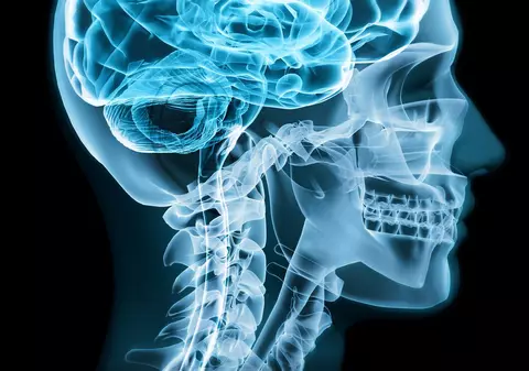 5 cauze pe care le poate avea boala Alzheimer's
