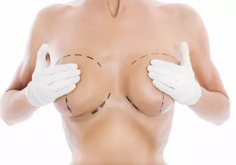 NOI DEZVĂLUIRI în Dosarul SILICOANELOR! Şi ASISTENTELE se ÎNFRUMUSEŢAU pe BANI publici