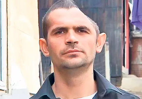 A trăit 11 luni fără jumătate de craniu