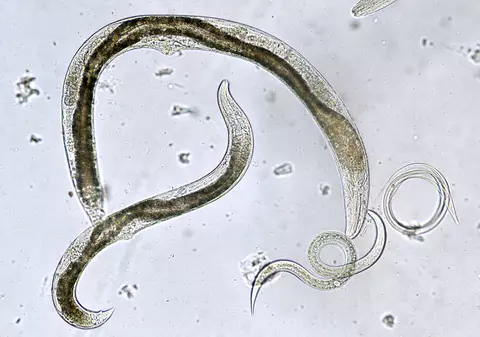 Cum scăpăm de oxiuri (viermi intestinali)