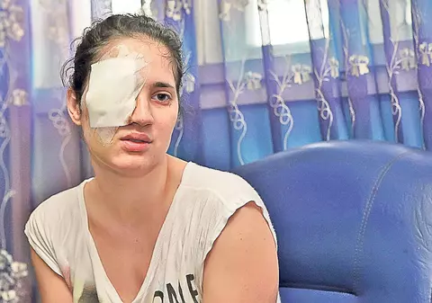 Fata împuşcată în ochi nu-şi găseşte serviciu