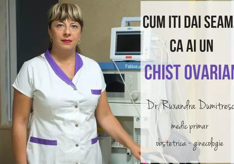 Ce este chistul ovarian și cum scapi de el