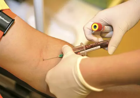 SPERANŢĂ. MAI MULŢI BANI pentru BOLNAVII DE HIV/SIDA