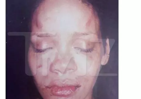 IMAGINI şi detalii ŞOCANTE | Iubita celebrului RAPPER Joe Budden : M-a BĂTUT la fel cum Chris Brown a bătut-o pe RIHANNA 