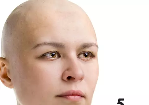5 semne că vei face cancer 