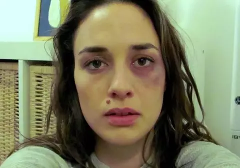 O TÂNĂRĂ şi-a făcut POZE, ZILNIC, timp de un an. FINALUL este DRAMATIC | VIDEO