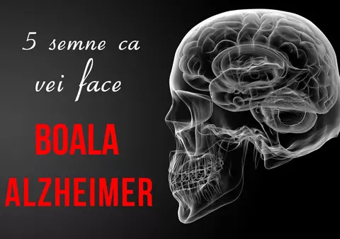 Semne că vei face Alzheimer