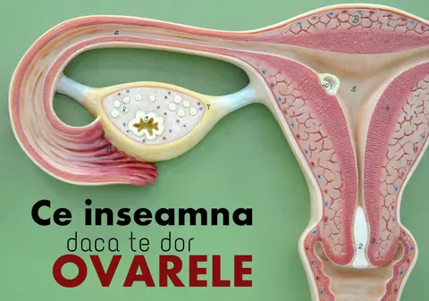 Durerea de ovare - ce înseamnă şi care sunt cauzele