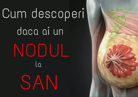 Cum descoperi dacă ai un nodul la sân