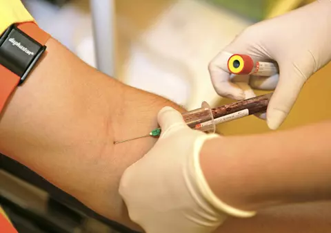 Un tânăr din Segarcea, suspectat că a infectat cu HIV zeci de persoane 