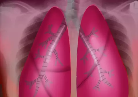 BOALA care afectează MILIOANE DE ROMÂNI şi DESPRE CARE MULŢI DINTRE NOI NU ŞTIU NIMIC