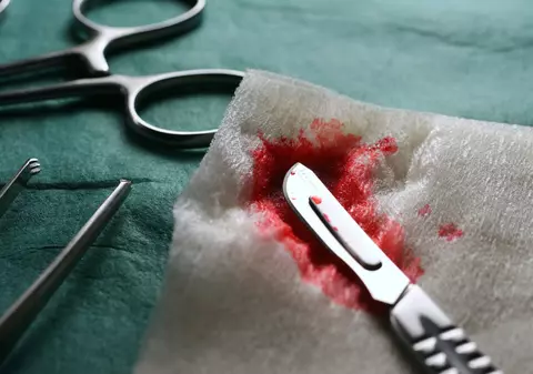 Medicul militar, ACUZAT de luare de MITĂ. Ar fi CERUT 1000 de euro pentru o OPERAȚIE