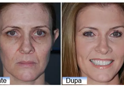 Desi are 52 ani, arata de 35. Modul in care a reusit sa scape de riduri te va lasa cu gura cascata!