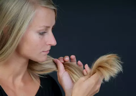 Ai mătreață? Poate fi semn de boală