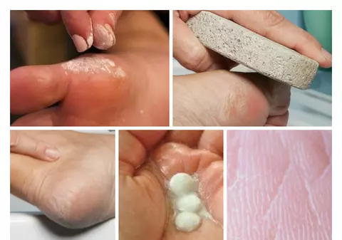5 moduri în care poți folosi aspirina