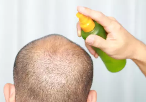 Cercetătorii au descoperit CUM SCAPI DE CHELIE