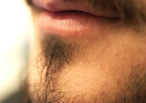 De ce au oamenii păr pe corp?