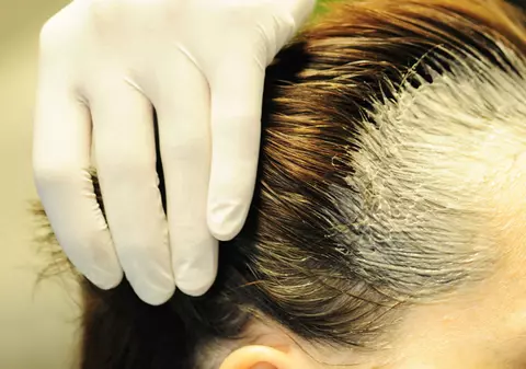 O studentă din Iaşi a ajuns de urgenţă la spital, după ce şi-a vopsit părul