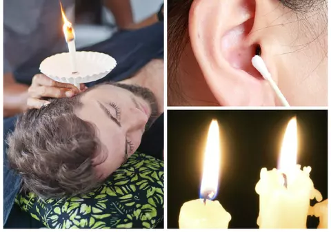 Cum scoţi ceara din ureche cu o lumânare | Video