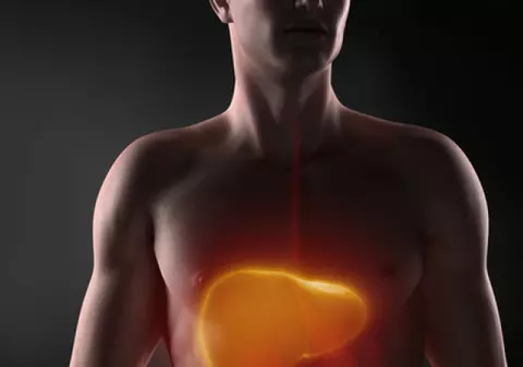 Ficatul gras – ce înseamnă şi care e tratamentul