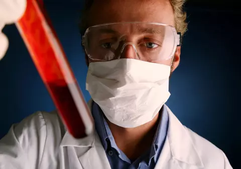 Cine a fost primul om infectat cu HIV? Cum a apărut epidemia de SIDA