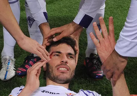 Accidentare stupidă pe Olimpico! Basanta a dat gol, iar un coechipier i-a spart arcada / GALERIE FOTO