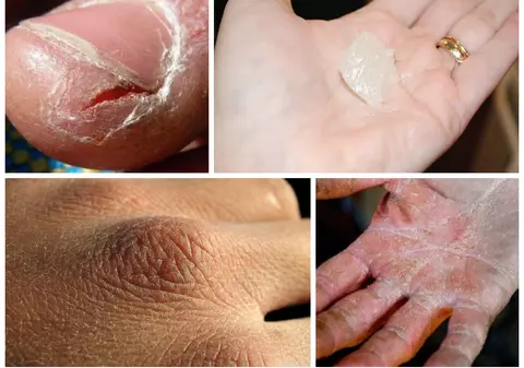 Crema magică de mâini pentru iarnă. O poţi face acasă!