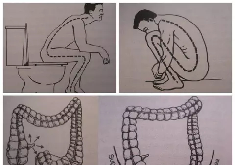 PE CÂT PARIU CĂ NU STAI CORECT PE WC? AFLĂ ADEVĂRUL DESPRE FOLOSIREA TOALETEI