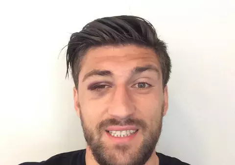 Paul Papp face haz de necaz pe seama accidentării suferite