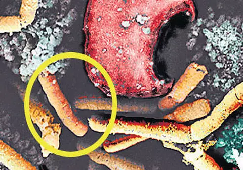 Autorităţile anunţă: campania naţională de vaccinare împotriva antraxului e în toi!