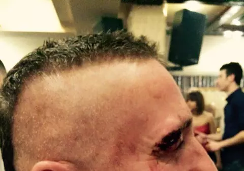 Nicu Maharu cu ochii umflați de pumni chiar de ziua lui!