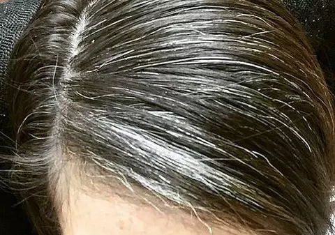 Amestecul din 2 ingrediente care ajută PĂRUL ALB să revină la culoarea iniţială