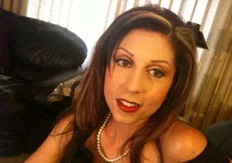 La 37 de ani, cântăreşte 18 kilograme. Drama unei femei care a făcut anorexie după ce a fost concediată VIDEO 