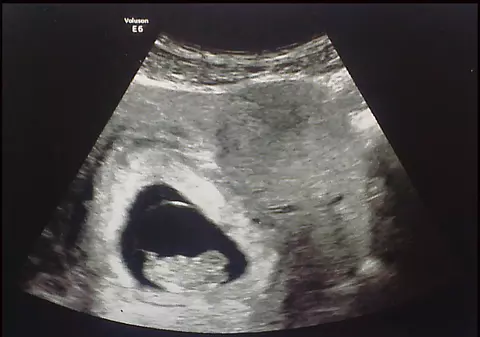 ÎNSĂRCINATĂ la 10 ANI! DECIZIA SFÂȘIETOARE pe care O IA GUVERNUL pentru copila nevinovată