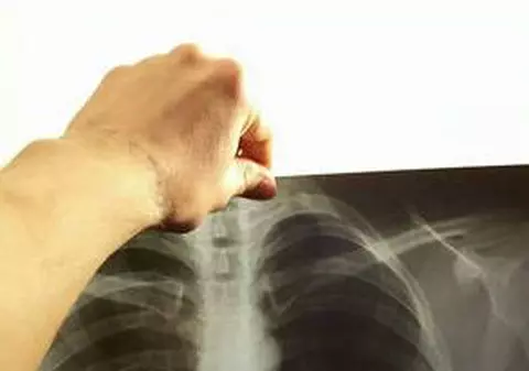 EMOŢII URIAŞE pentru ANDREI LEONTE. I-au spus că are PNEUMONIE cu o săptămână înainte să meargă la EUROVISION cu băieţii de la VOLTAJ