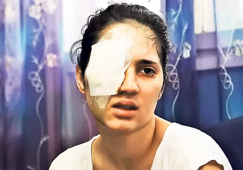 Prețul împăcării: 125.000 €! Fata împușcată în ochi a bătut palma cu pistolarul din Militari