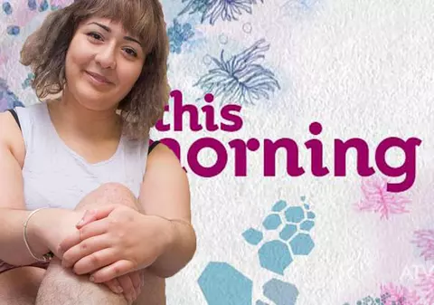 Tânăra care nu s-a epilat de 11 ani, umilită de un post TV. "Nu am fost destul de ieşită din comun pentru ei"