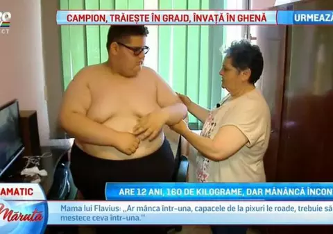 De necrezut! Un băiat de 12 ani din Sibiu cântărește 160 de kilograme