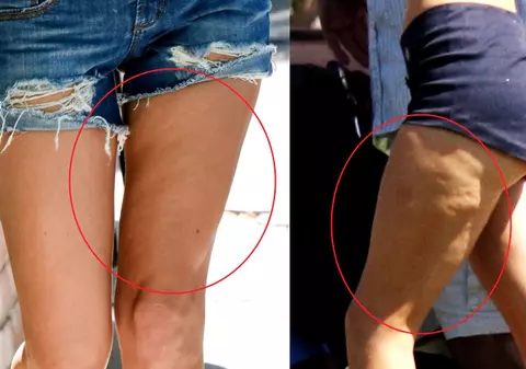 Două cauze uimitoare pentru care îți apare CELULITĂ! Faci asta aproape zilnic și nu știi că-ți distruge trupul