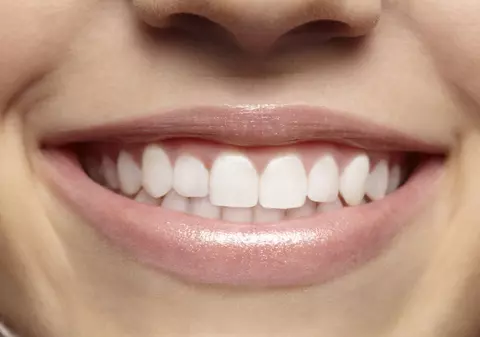 6 metode naturale de albire a dinţilor