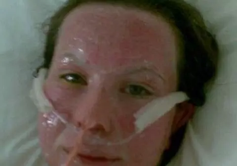 Era comparată cu un monstru la 17 ani, dar acum s-a ”VINDECAT”. Fata asta a suferit O TRANSFORMARE SENZAȚIONALĂ! FOTO