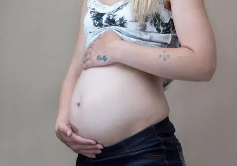 Arată ca o femeie însărcinată, deşi a născut în urmă cu 17 luni! Doctorii nu ştiu de ce afecţiune suferă | FOTO